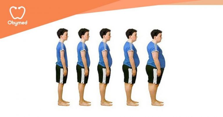 Tipos de obesidad o gordura